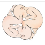 У вас будет малыш